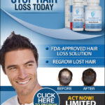 Provillus Receding Hairline Treatment For Men