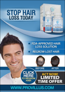 Provillus Receding Hairline Treatment For Men