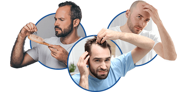 How to Stop a Receding Hairline