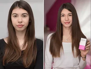 Woman happy after using Locerin for 3 Months