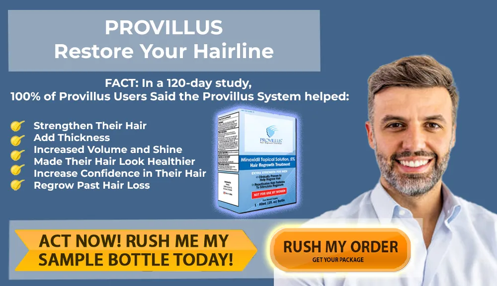 Official Provillus dual-action hair restoration system banner featuring the specialized oral dietary supplement matrix and topical minoxidil solution for advanced androgenetic alopecia treatment.